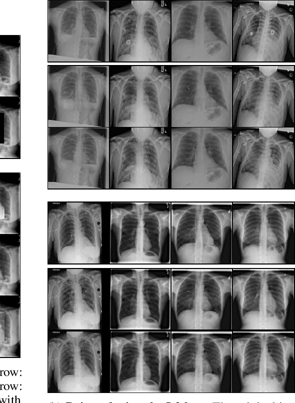 Figure 4 for Chest X-Rays Image Inpainting with Context Encoders