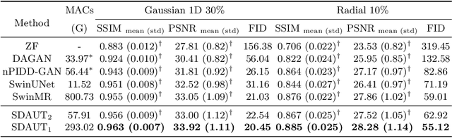 Figure 2 for Swin Deformable Attention U-Net Transformer (SDAUT) for Explainable Fast MRI