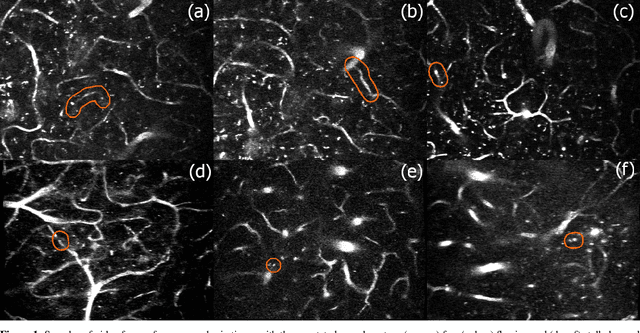 Figure 1 for 3D Convolutional Neural Networks for Stalled Brain Capillary Detection