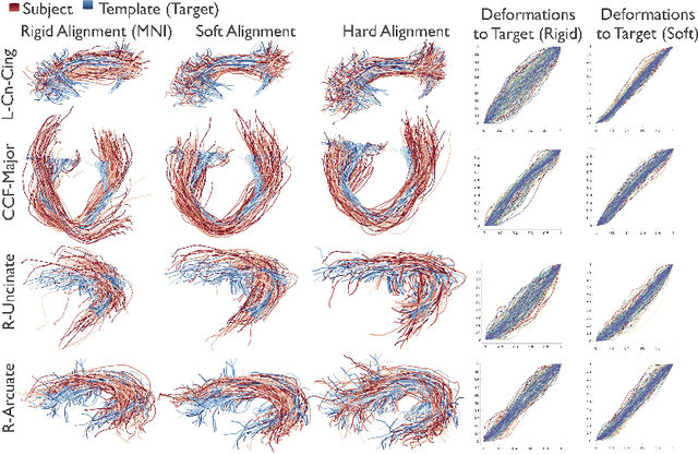 Figure 3 for Alignment of Tractography Streamlines using Deformation Transfer via Parallel Transport