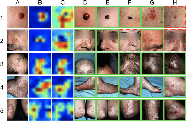 Figure 4 for A Deep Multi-task Learning Approach to Skin Lesion Classification