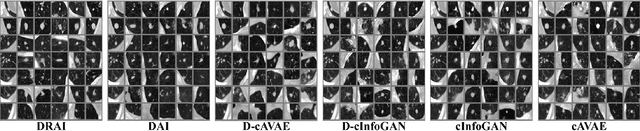 Figure 2 for Conditional Generation of Medical Images via Disentangled Adversarial Inference