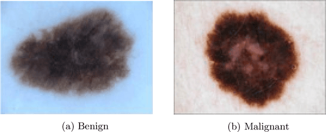Figure 1 for Denoising Adversarial Autoencoders: Classifying Skin Lesions Using Limited Labelled Training Data