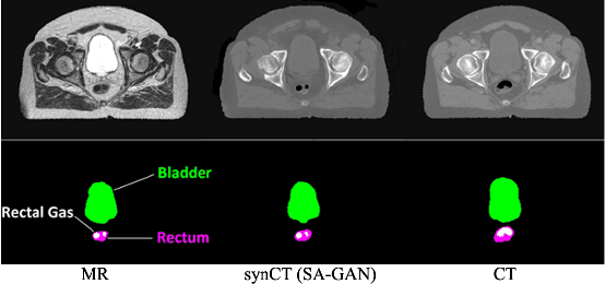 Figure 1 for SA-GAN: Structure-Aware Generative Adversarial Network for Shape-Preserving Synthetic CT Generation
