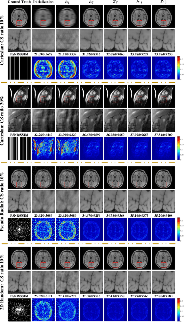 Figure 4 for A Unifying Multi-sampling-ratio CS-MRI Framework With Two-grid-cycle Correction and Geometric Prior Distillation