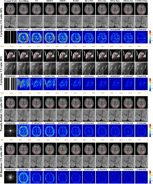 Figure 2 for A Unifying Multi-sampling-ratio CS-MRI Framework With Two-grid-cycle Correction and Geometric Prior Distillation