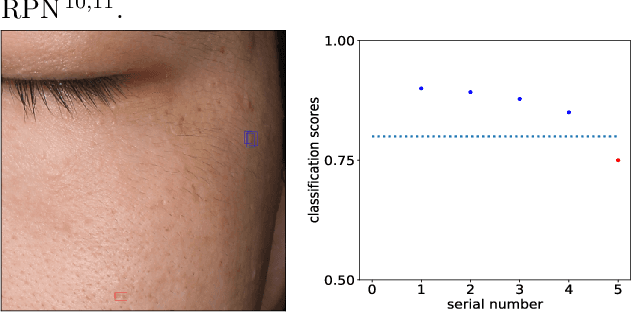 Figure 3 for Learning High-quality Proposals for Acne Detection
