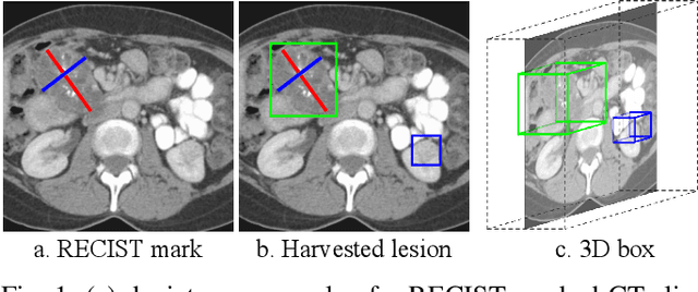 Figure 1 for Lesion Harvester: Iteratively Mining Unlabeled Lesions and Hard-Negative Examples at Scale