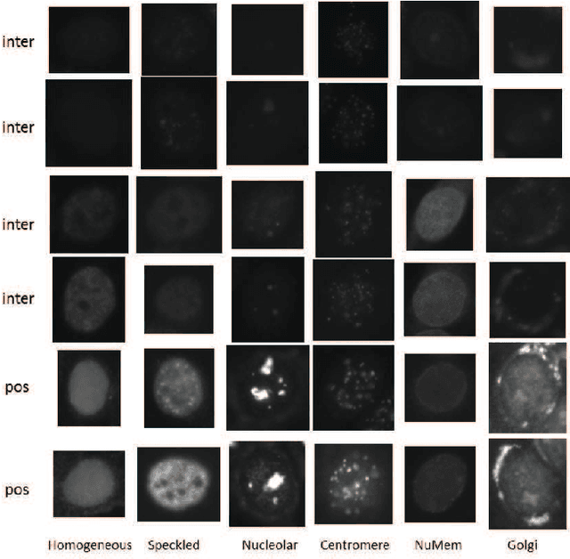 Figure 1 for HEp-2 Cell Classification via Fusing Texture and Shape Information