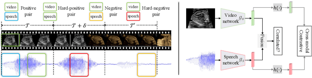 Figure 3 for Self-supervised Contrastive Video-Speech Representation Learning for Ultrasound