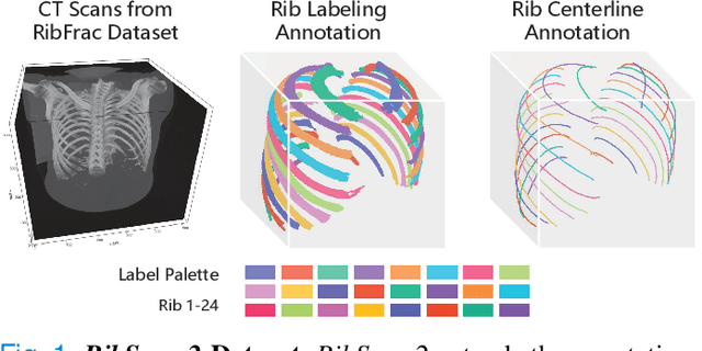 Figure 1 for RibSeg v2: A Large-scale Benchmark for Rib Labeling and Anatomical Centerline Extraction