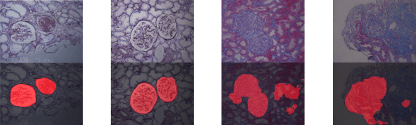 Figure 1 for Cross-stained Segmentation from Renal Biopsy Images Using Multi-level Adversarial Learning