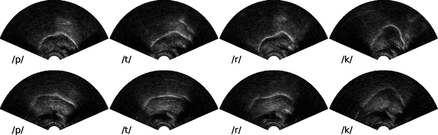 Figure 1 for Speaker-independent classification of phonetic segments from raw ultrasound in child speech