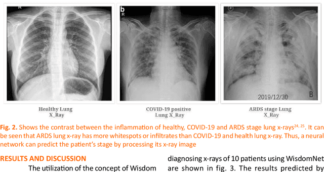 Figure 2 for WisdomNet: Prognosis of COVID-19 with Slender Prospect of False Negative Cases and Vaticinating the Probability of Maturation to ARDS using Posteroanterior Chest X-Rays