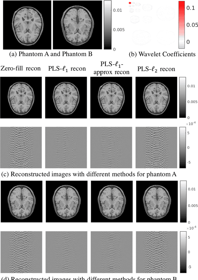Figure 3 for Reconstruction-Aware Imaging System Ranking by use of a Sparsity-Driven Numerical Observer Enabled by Variational Bayesian Inference