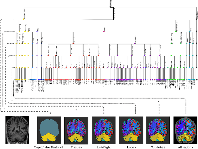 Figure 1 for Hierarchical brain parcellation with uncertainty