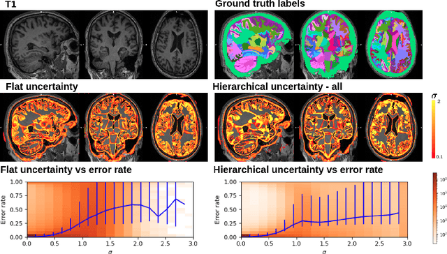 Figure 3 for Hierarchical brain parcellation with uncertainty