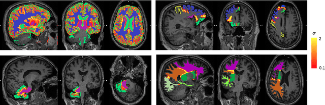Figure 4 for Hierarchical brain parcellation with uncertainty