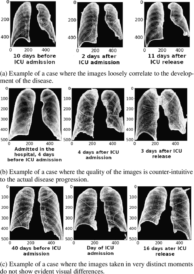 Figure 4 for MAVIDH Score: A COVID-19 Severity Scoring using Chest X-Ray Pathology Features