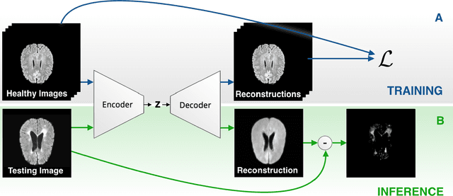 Figure 1 for Autoencoders for Unsupervised Anomaly Segmentation in Brain MR Images: A Comparative Study