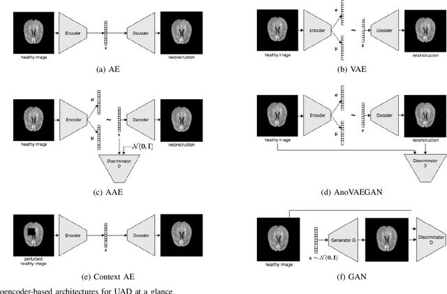 Figure 4 for Autoencoders for Unsupervised Anomaly Segmentation in Brain MR Images: A Comparative Study