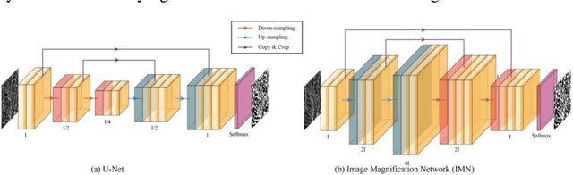 Figure 3 for Image Magnification Network for Vessel Segmentation in OCTA Images