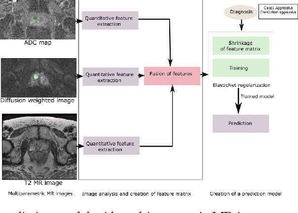 Figure 1 for Computerized Multiparametric MR image Analysis for Prostate Cancer Aggressiveness-Assessment