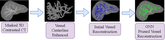 Figure 1 for Graph Attention Network based Pruning for Reconstructing 3D Liver Vessel Morphology from Contrasted CT Images