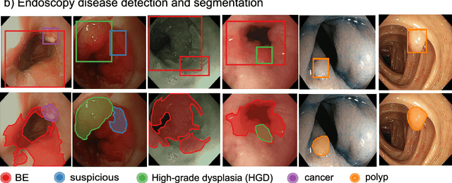 Figure 1 for A translational pathway of deep learning methods in GastroIntestinal Endoscopy