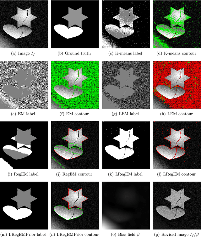 Figure 4 for Image Segmentation with Adaptive Spatial Priors from Joint Registration