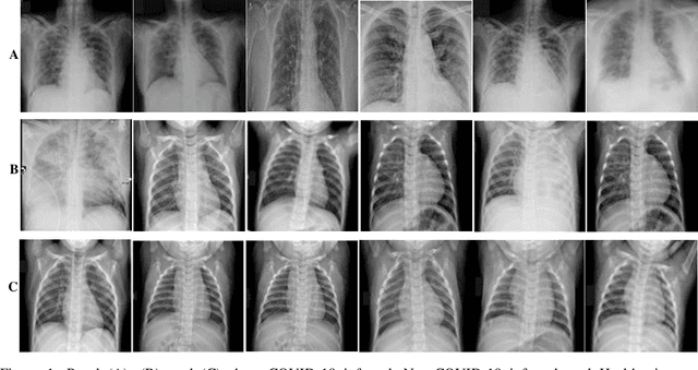Figure 1 for COVID-19 Detection in Chest X-Ray Images using a New Channel Boosted CNN