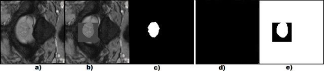 Figure 1 for On the Impact of Interpretability Methods in Active Image Augmentation Method