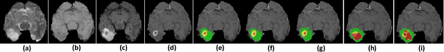 Figure 1 for ACN: Adversarial Co-training Network for Brain Tumor Segmentation with Missing Modalities