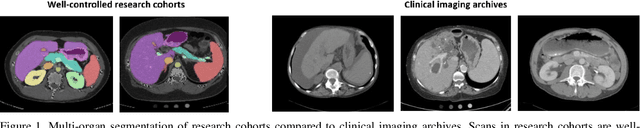 Figure 1 for Validation and Optimization of Multi-Organ Segmentation on Clinical Imaging Archives