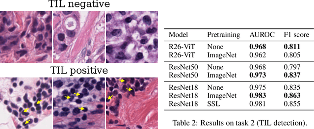 Figure 3 for Evaluating histopathology transfer learning with ChampKit