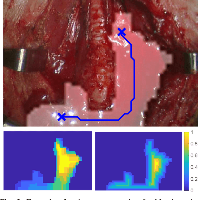 Figure 3 for Autonomous Robotic Suction to Clear the Surgical Field for Hemostasis using Image-based Blood Flow Detection