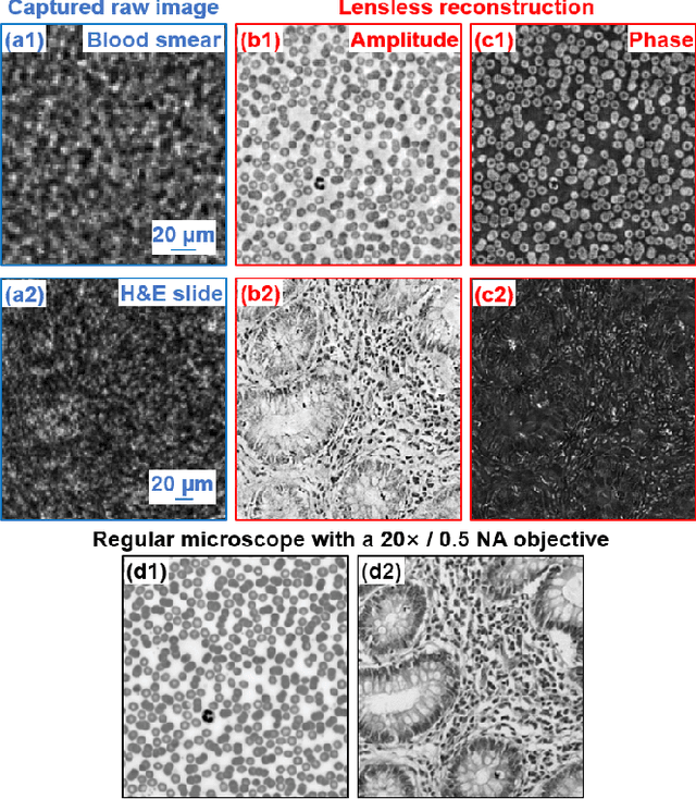 Figure 4 for High-throughput lensless whole slide imaging via continuous height-varying modulation of tilted sensor