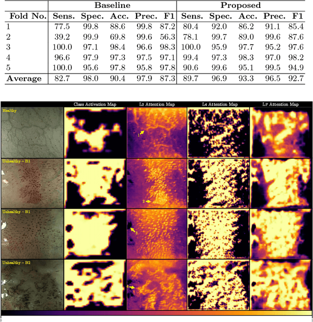 Figure 4 for Interpretable Fully Convolutional Classification of Intrapapillary Capillary Loops for Real-Time Detection of Early Squamous Neoplasia
