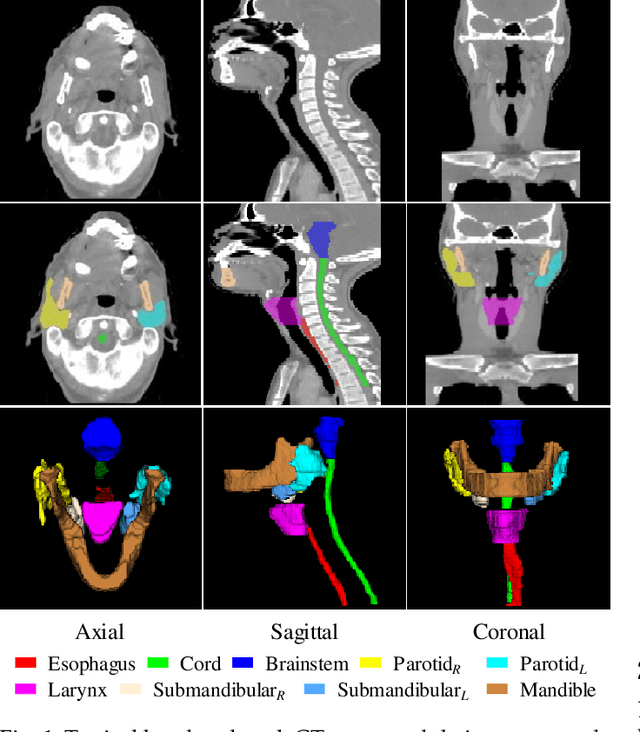 Figure 1 for Dual Shape Guided Segmentation Network for Organs-at-Risk in Head and Neck CT Images