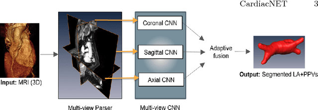 Figure 1 for CardiacNET: Segmentation of Left Atrium and Proximal Pulmonary Veins from MRI Using Multi-View CNN