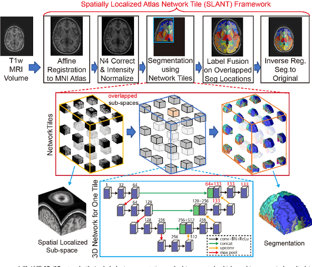 Figure 1 for 3D Whole Brain Segmentation using Spatially Localized Atlas Network Tiles