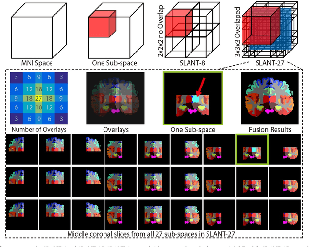 Figure 3 for 3D Whole Brain Segmentation using Spatially Localized Atlas Network Tiles