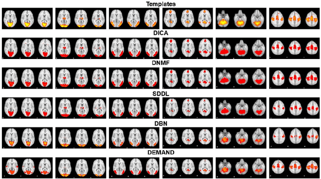 Figure 1 for DEMAND: Deep Matrix Approximately Nonlinear Decomposition to Identify Meta, Canonical, and Sub-Spatial Pattern of functional Magnetic Resonance Imaging in the Human Brain