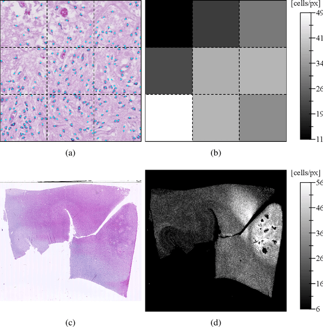 Figure 2 for Initial condition assessment for reaction-diffusion glioma growth models: A translational MRI/histology (in)validation study