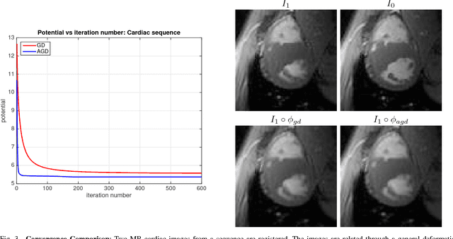 Figure 3 for Accelerated Optimization in the PDE Framework: Formulations for the Manifold of Diffeomorphisms