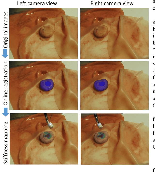 Figure 3 for A surgical system for automatic registration, stiffness mapping and dynamic image overlay