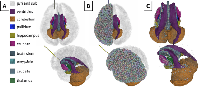 Figure 3 for Position-based Dynamics Simulator of Brain Deformations for Path Planning and Intra-Operative Control in Keyhole Neurosurgery