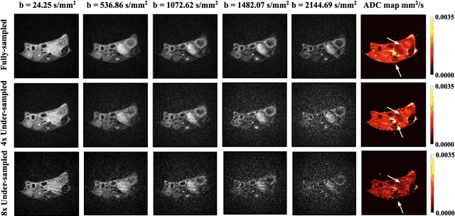 Figure 2 for Learning Apparent Diffusion Coefficient Maps from Undersampled Radial k-Space Diffusion-Weighted MRI in Mice using a Deep CNN-Transformer Model in Conjunction with a Monoexponential Model