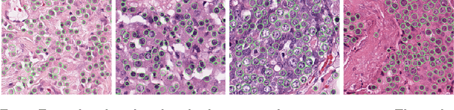 Figure 3 for Cutting out the middleman: measuring nuclear area in histopathology slides without segmentation