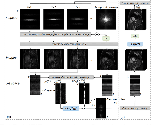 Figure 1 for k-t NEXT: Dynamic MR Image Reconstruction Exploiting Spatio-temporal Correlations